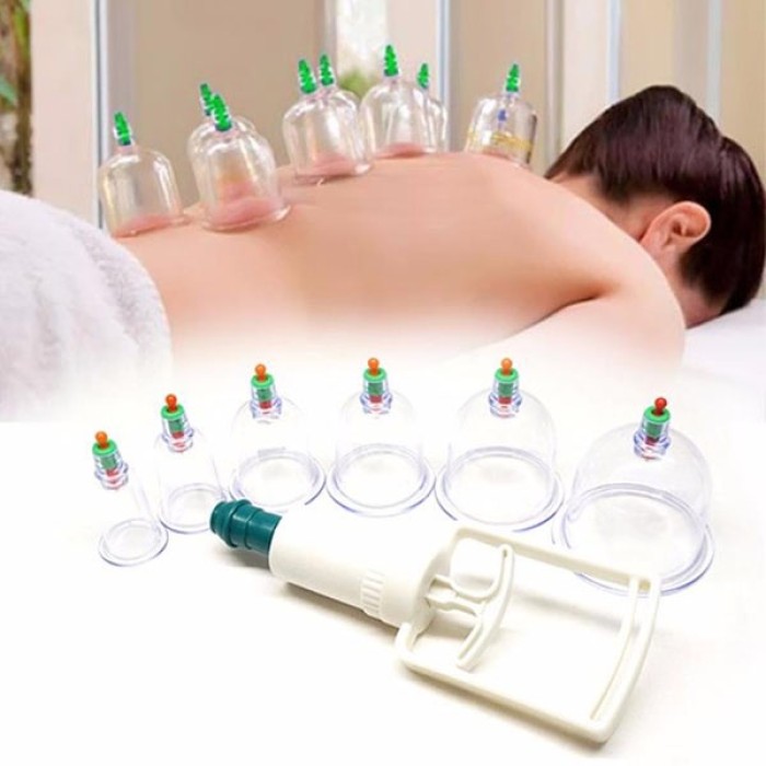 Bộ giác hơi không dùng lửa 24 phụ kiện KAW, Giảm đau nhức, Tăng cường tuần hoàn máu
